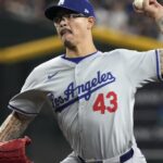 Dodgers relief pitcher Anthony Banda breaks hand in unusual manner